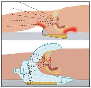 4pubella glutei