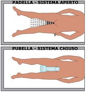 Pubella sistema aperto chiuso